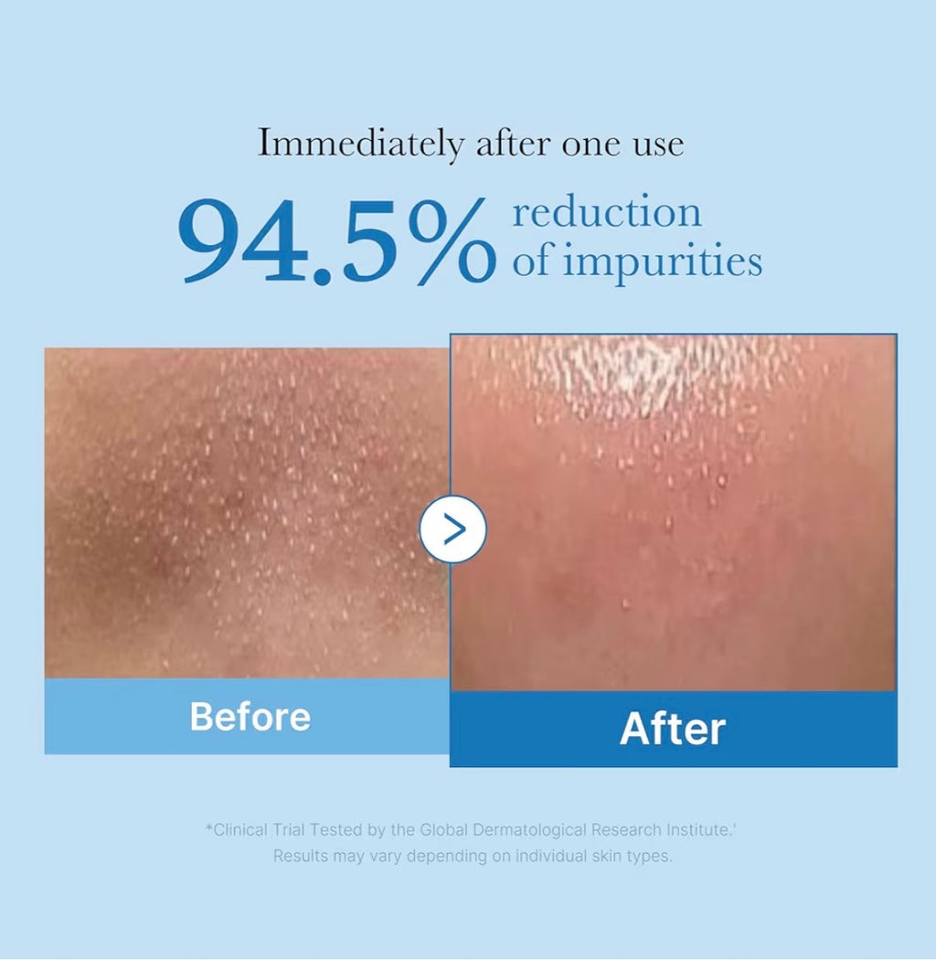 Medicube Zero Pore Aceite Limpiador De Puntos Negros
